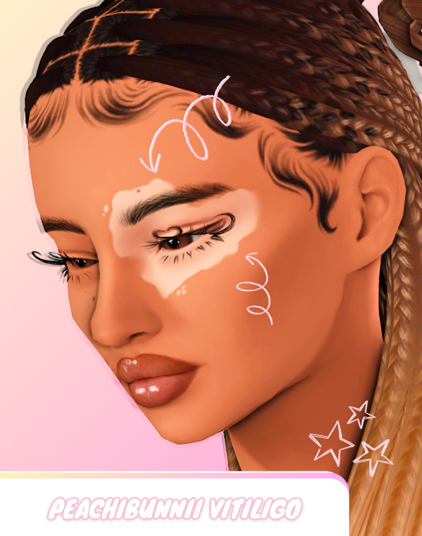 Maxis Match Peachi Vitiligo V1 by simsfinds - The Sims 4 Custom Content