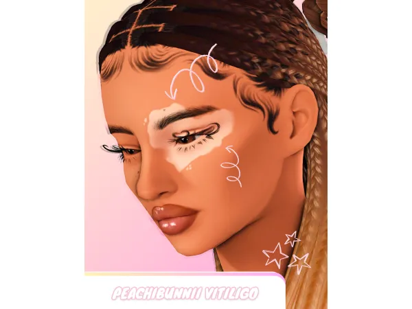 Peachi Vitiligo V1 by Peachibunnii