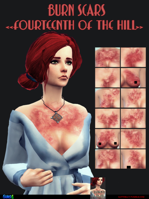 Mix Burn scars Fourteenth of the Hill by simsfinds - The Sims 4 Custom Content