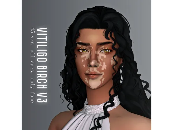 Vitiligo "Birch" Version 3 by Jarride