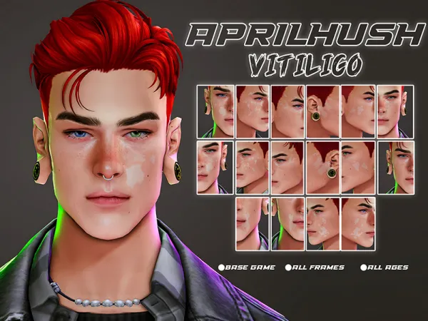 Maxis Match [aprilhush] vitiligo by aprilhush - The Sims 4 Custom Content